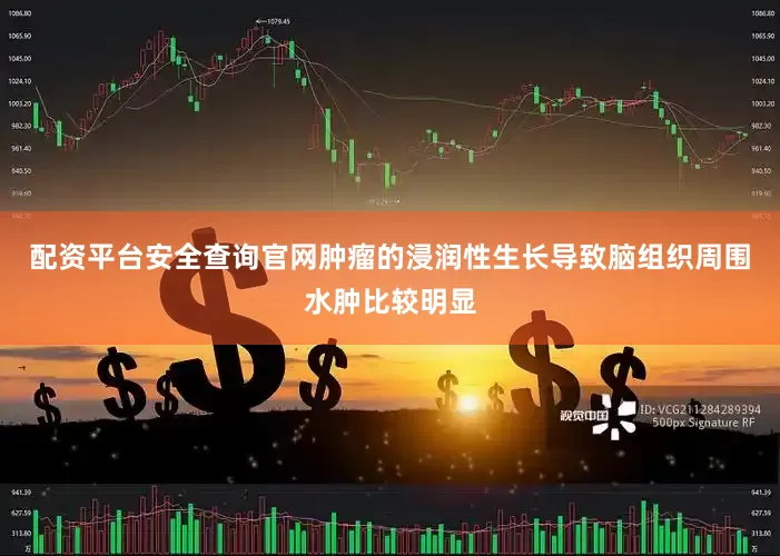 配资平台安全查询官网肿瘤的浸润性生长导致脑组织周围水肿比较明显